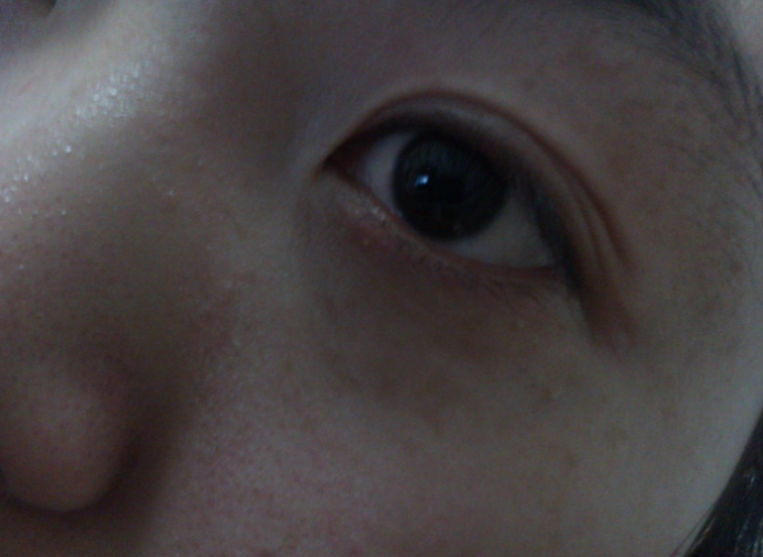 雪雪的鱼|人体出现3种异常,肝脏或已“烂如渔网”,劝你切莫忽视