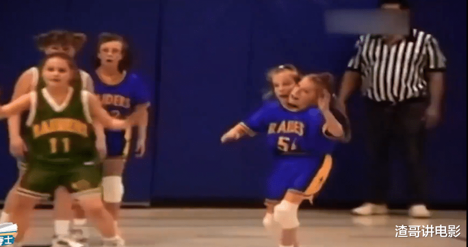 中国科学院|世界上真实存在的双头人，姐妹共用一个身体，却分别控制半边身体