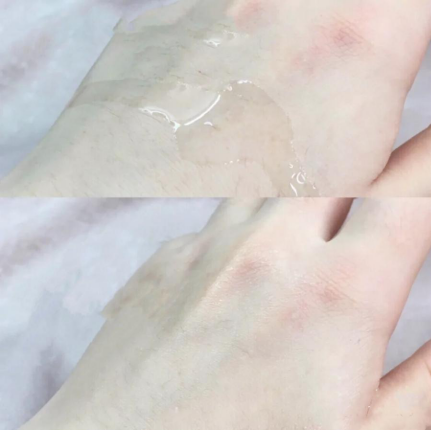 防晒|怀孕了就别乱用护肤品!烂脸是小,危害宝宝健康就得不偿失