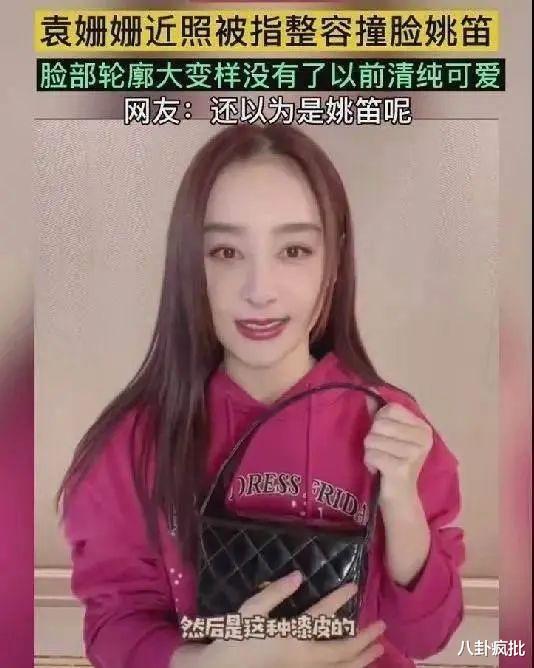 张雨绮|张雨绮脸僵鼻子怪，过度医美惹的祸？