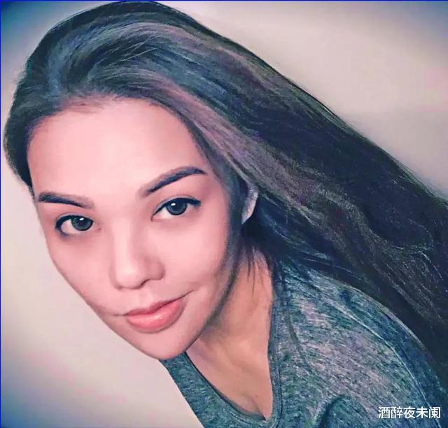 音乐之声|演员高溜整容失败，鼻头坏死触目惊心，曾多次想自杀：整容需谨慎