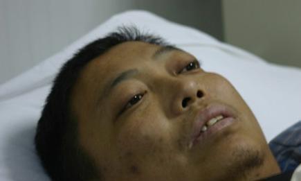 水果|36岁男子不沾烟酒，确认肝癌，医生提醒：这种水果比烟酒还伤肝