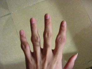 白发|痛风能喝咖啡吗？专家：3物是痛风的“克星”，尿酸高不妨多吃