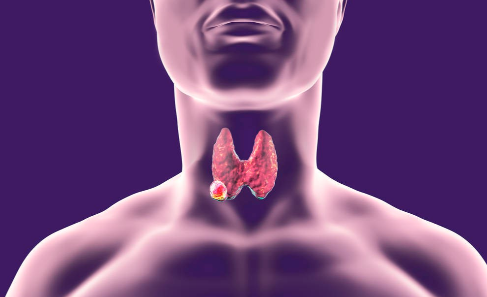 跑步|身体长结节?分享:一个简单的招数!每天刮刮脚趾头,消散结节