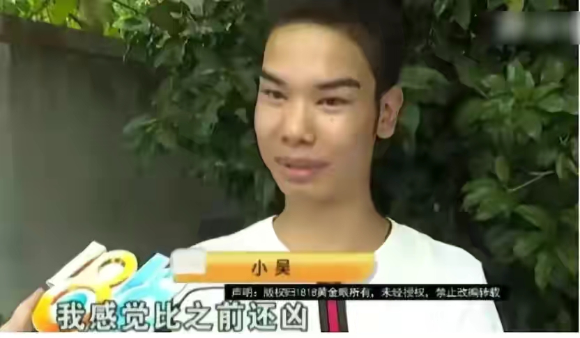 发际线|发际线男孩小吴，一年多没见，模样大变，看起来他过的不错