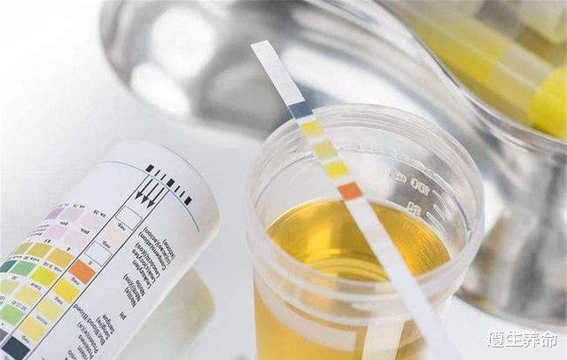 尿酸|尿酸高的人只能喝白开水？医生建议：这3种“饮料”或有助于降酸