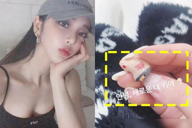 Angelababy|“韩国angelababy”火了！右耳失聪颜值爆表，凭身材开挂吸粉千万