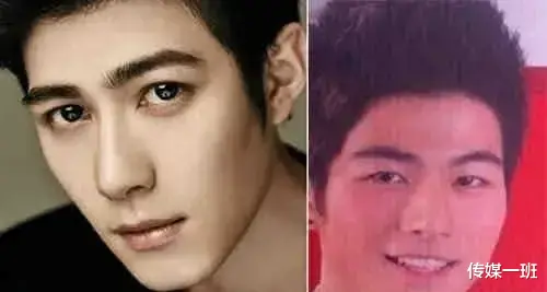 陈浩民|男明星动脸现状：郭晋安面部肌肉僵硬，陈浩民被嘲“翻版马里奥”