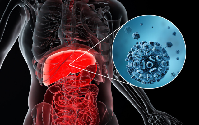 养生|癌细胞“偏爱”3种早餐,鸡蛋在内,医生:不想病魔登门,尽量管住嘴
