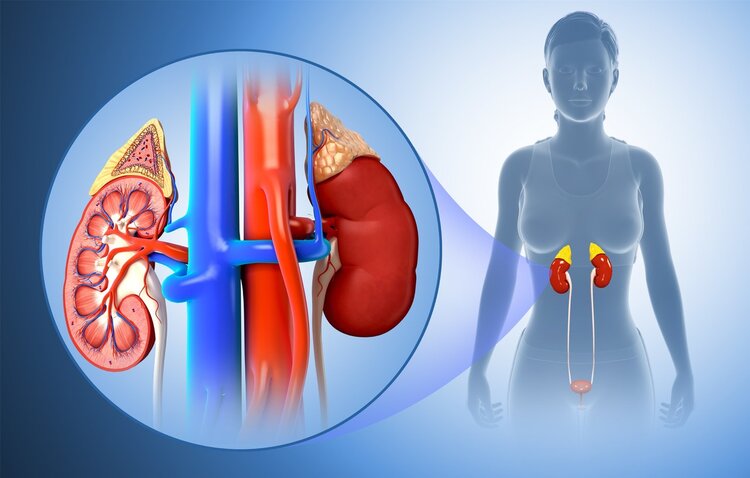 肾结石|媳妇熬的汤喝了一年多，结果喝出尿毒症，医生：你媳妇干的“好”