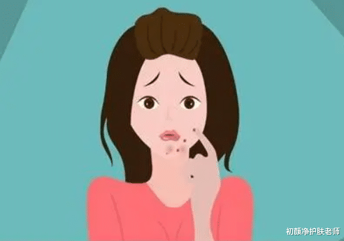 化妆品 为什么你一化妆就长痘？问题可能出在这些细节上！