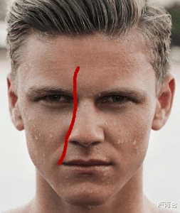 痔疮|一条伤疤要看三、四个科室,是医生在骗钱吗?