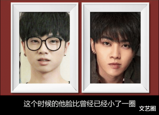 华晨宇|女网红直言华晨宇整容，称其变脸经历了三个阶段：打瘦脸针、减肥、面部削骨