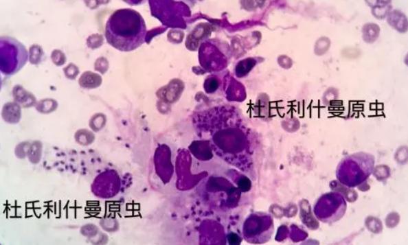 猪肉|吃掉脸、钻进眼,隐藏在人体内恐怖的“寄生虫”,你知道几个?