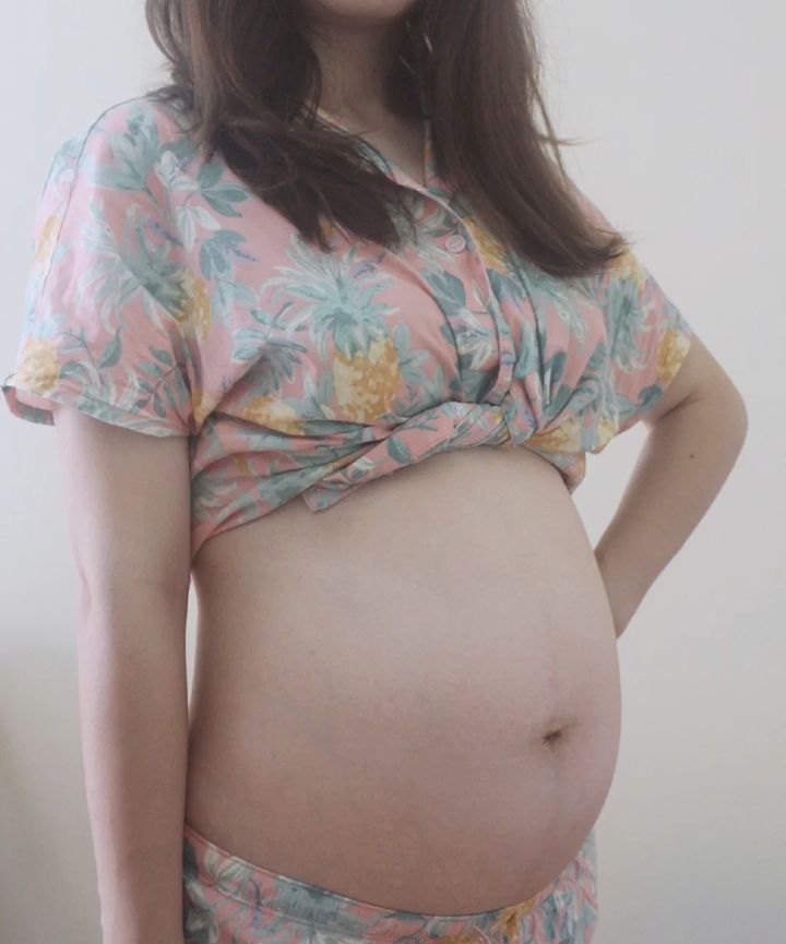 樱桃妈咪|妊娠纹大作战!做好预防工作,妇产医生都夸的“零孕纹”肚皮!