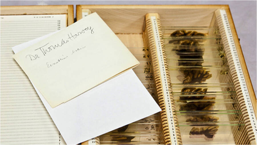 爱因斯坦 阿尔伯特·爱因斯坦大脑的奇异故事——从他的身体被盗后