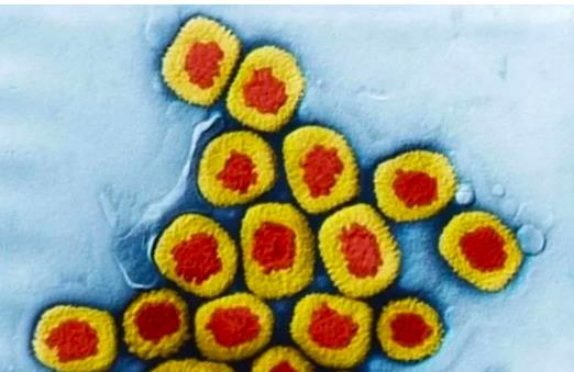 地球仅存的天花病毒保存在美俄,WHO多次提议销毁,它们为何不肯