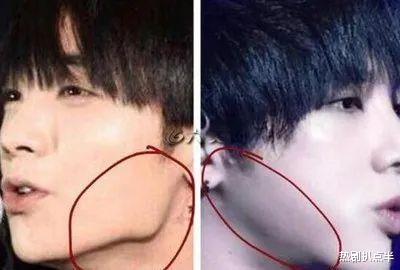 陈小纭|4位明星动脸后遗症：陈小纭脸部僵硬合不上嘴，华晨宇下巴太尖锐