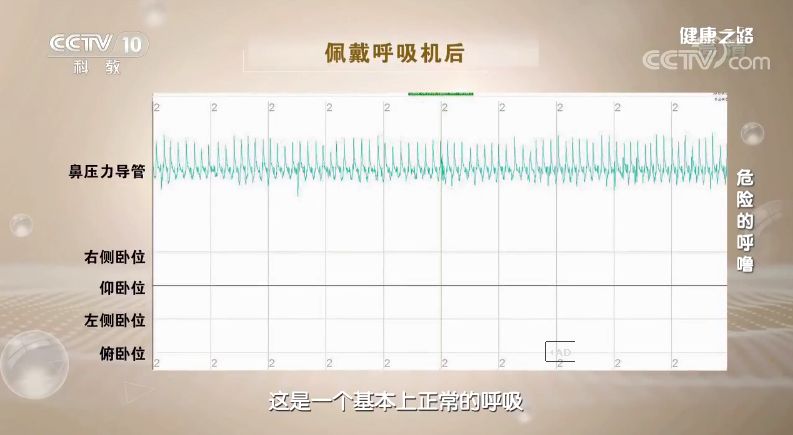 佳康时代|打鼾隐患大,严重者会猝死,央视多次报道提醒早治疗!