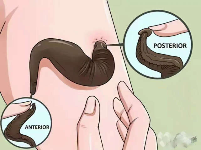  水蛭如果被人不小心吃肚子里了，水蛭在人的肚子里还可以活吗？