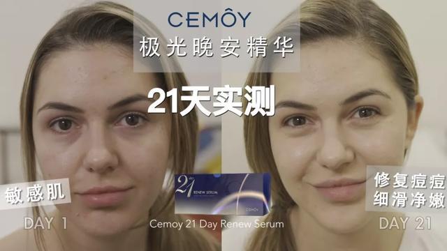 天蝎座|王鸥、张嘉倪公开了抗氧化秘诀:一天一片,21天肌肤光滑透亮