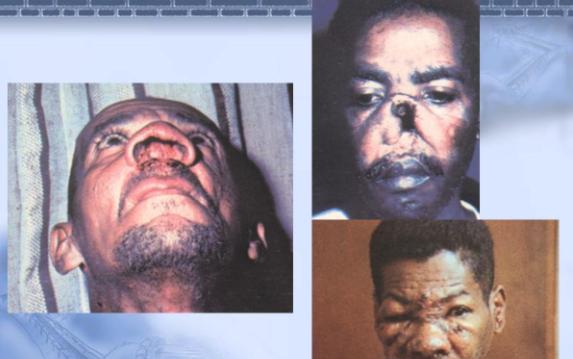 猪肉|吃掉脸、钻进眼,隐藏在人体内恐怖的“寄生虫”,你知道几个?