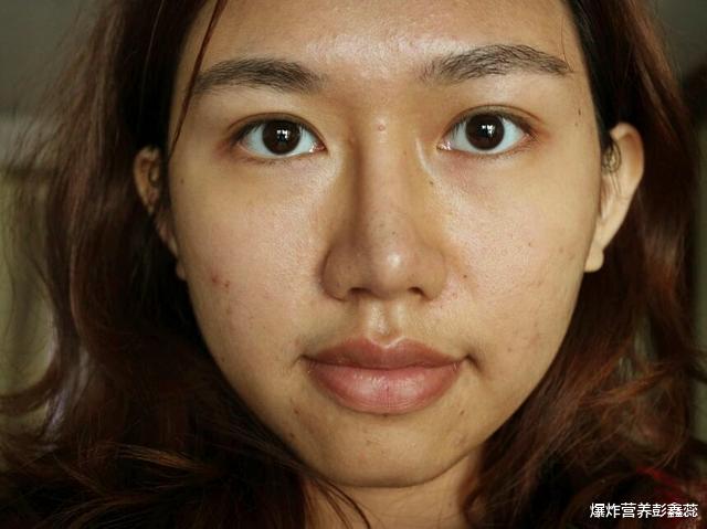 爆炸营养彭鑫蕊|不想被别人叫 “黄脸婆”,从25岁后,要少吃这三种热量超标的水果