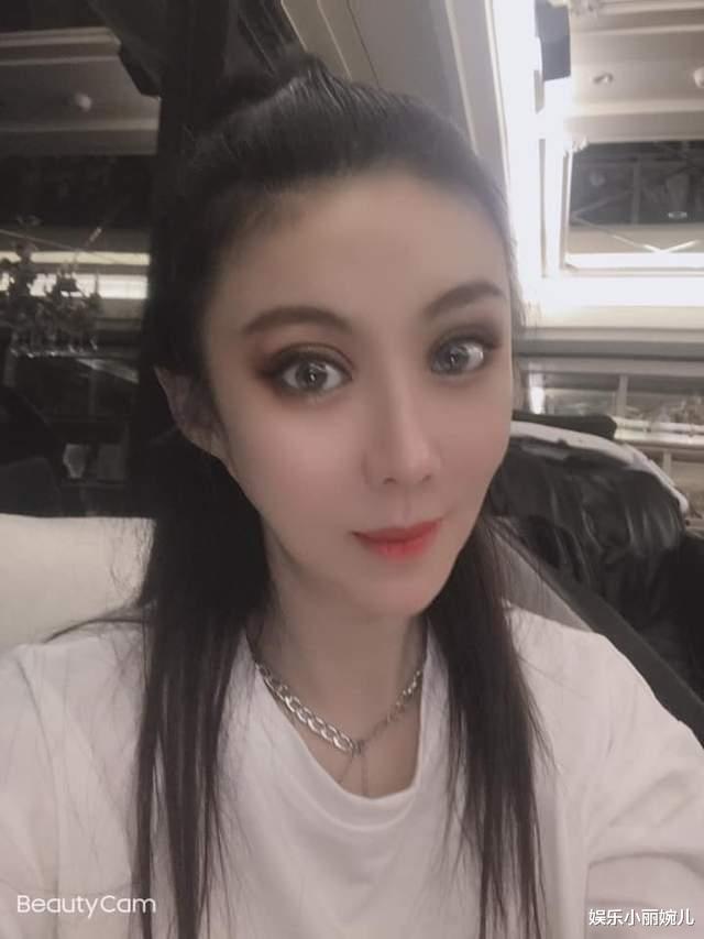 台湾女星肠爆裂被紧急送往医院抢救,住加护病房曾遭陌生男子偷窥