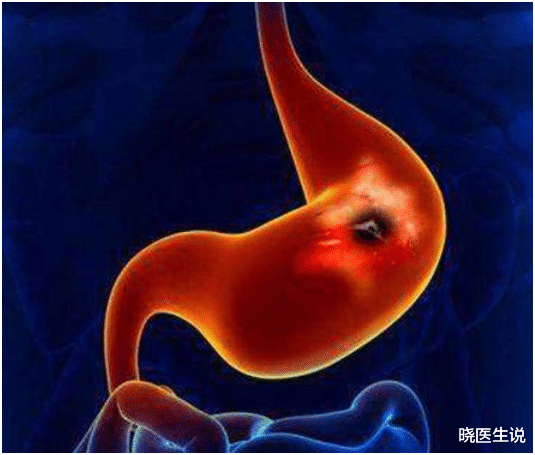 晓医生说|老中医养胃：经常胃痛是胃寒，胃口不好是胃虚，你的胃还好吗？