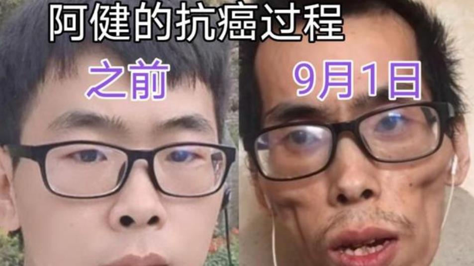 抗癌|又一憾事！抗癌网红阿健去世，遗照和去世前瘦成皮包骨判若两人