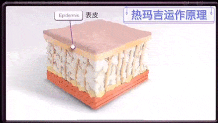 小美说美|如果每年都做热玛吉，突然不做了皮肤会变得更差？