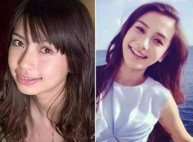Angelababy|有一种“整容”叫傅园慧，整牙后看呆众人，网友：终于相信baby了