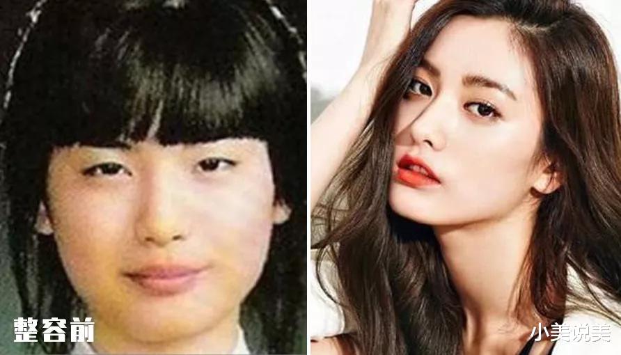 小美说美 究竟怎样才能整出自然、精致的鼻子呢?