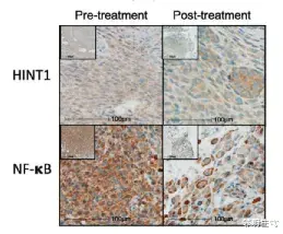  冬虫夏草能抗癌？最新研究来了！已开始临床实验