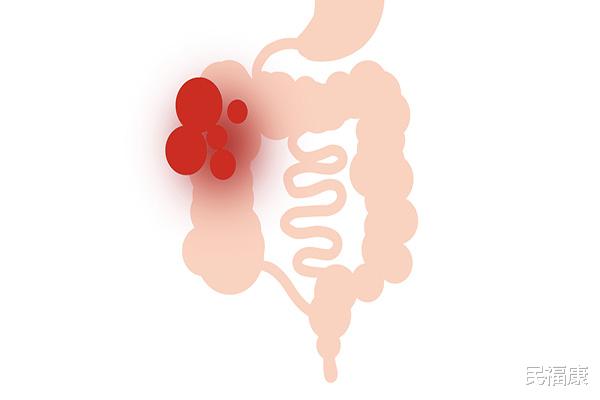 衰老|过了五十岁，身体开始明显衰老，想要老得慢点，做好四点