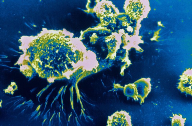 白发|这三种蔬菜，可能都是癌细胞的“仓库”，请尽快从餐桌上撤掉