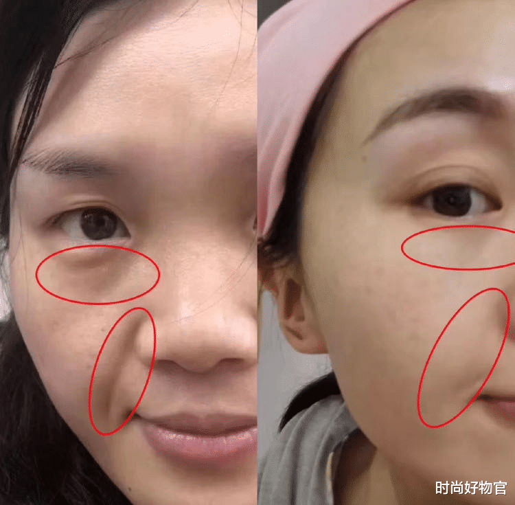 时尚好物官|乡村女子使用美容仪长达9年，如今变成了什么样？老公：后悔莫及
