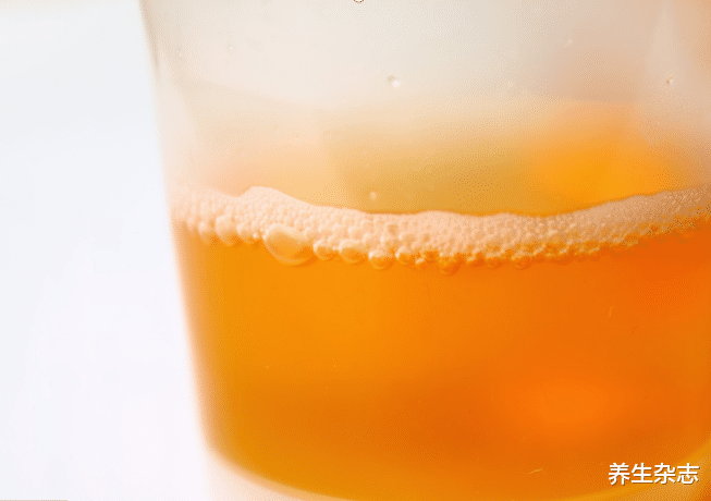 贫血|肝脏变硬，上厕所先知？医生：上厕所有4种异常，趁早检查肝CT