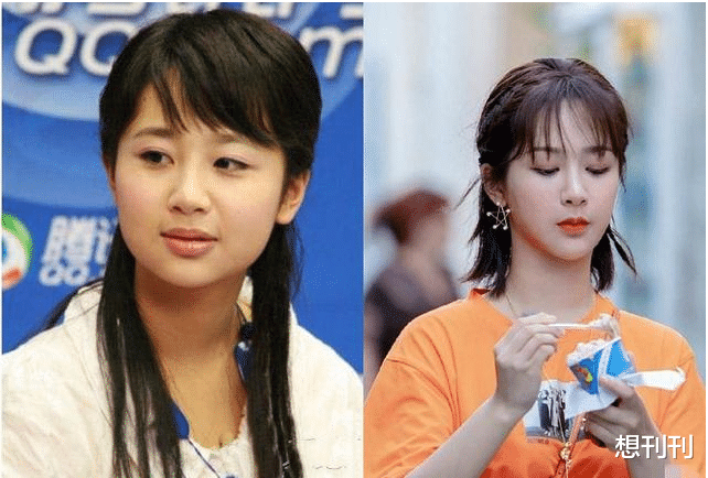 后遗症|做了颧骨内推的明星真的变美了吗?推平容易后悔难,后遗症一大堆