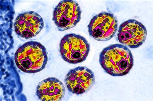 同基声|HIV/艾滋病疫苗试验再遇挫