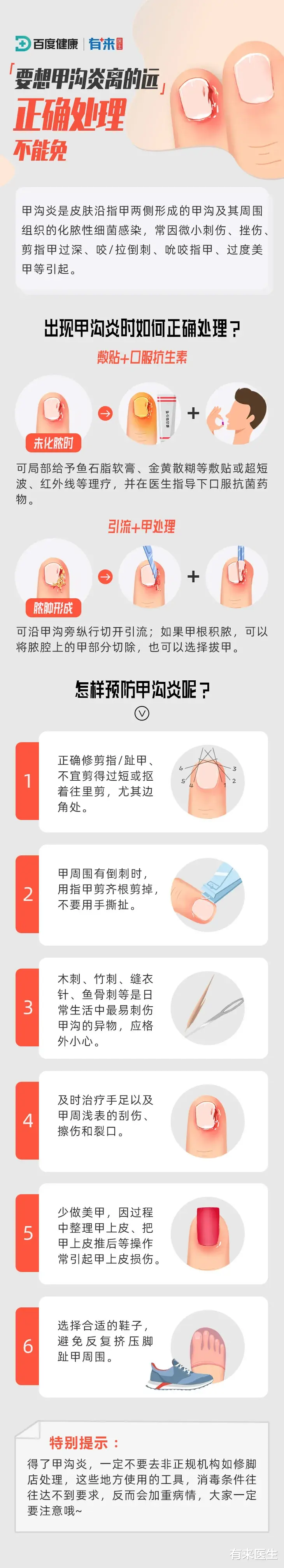 有来医生|甲沟炎是“剪”出来的？处理不好，真是十指连心的痛啊！