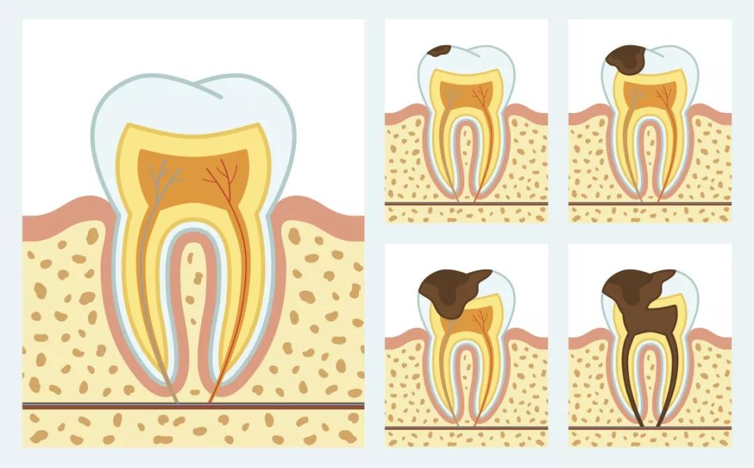 牙齿|当事人：之前牙齿有点疼，之后就没有之后了