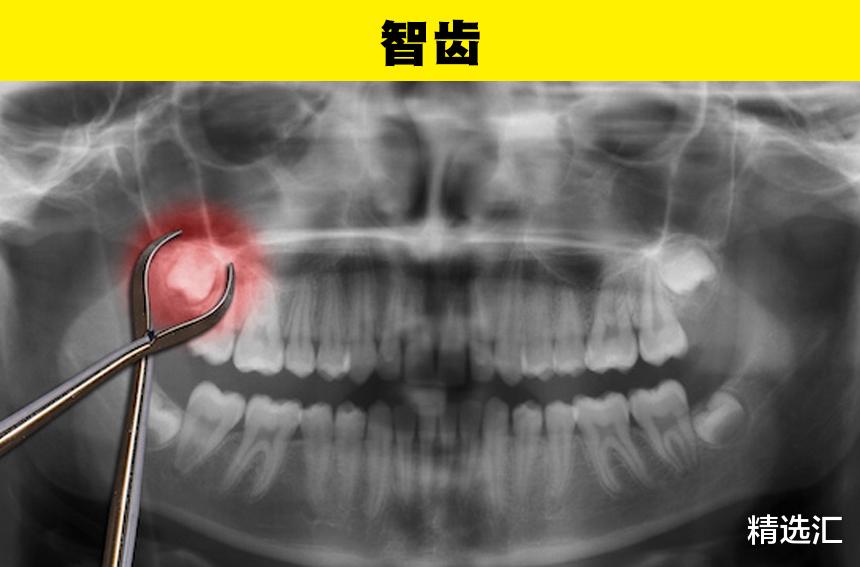 |仅有少数人的身上拥有的7个身体特征
