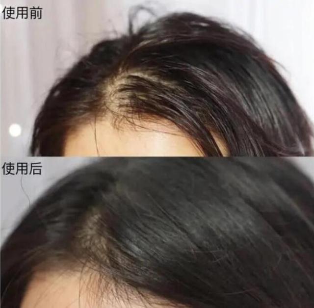 短发|头发刚浸湿就涂洗发水,难怪头屑严重还掉发,告诉你正确洗发方式