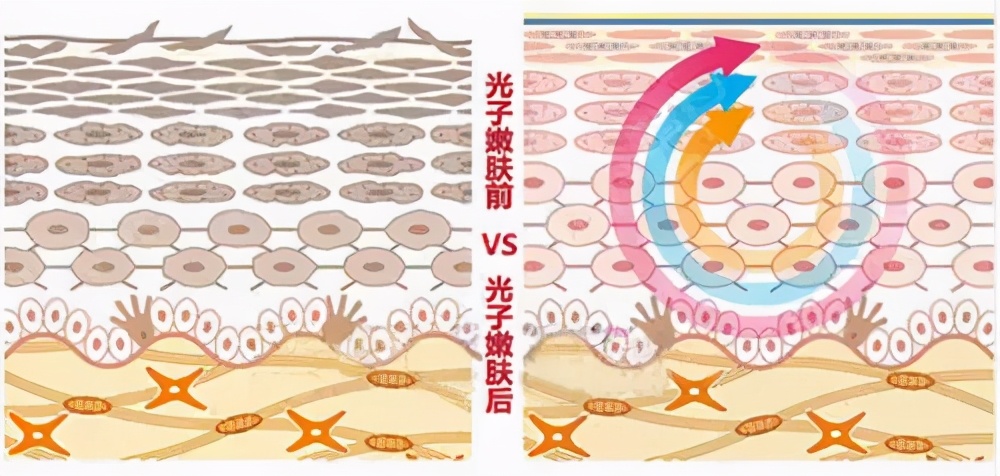 医美|秋季适合做哪些医美护肤项目
