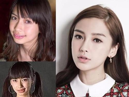 整容|10位当红女星整容前后：顿时感觉我也能出道了哈哈