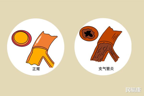 戒烟|吸烟对身体有哪些伤害?关于吸烟的误区你知道几个?