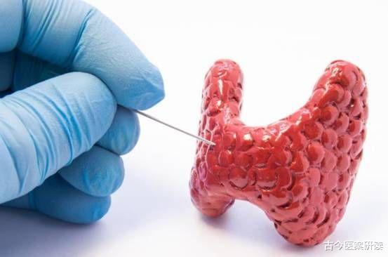 补钙|女子复查甲状腺结节转癌，医生：天天做这“1事”，身体不报废才怪