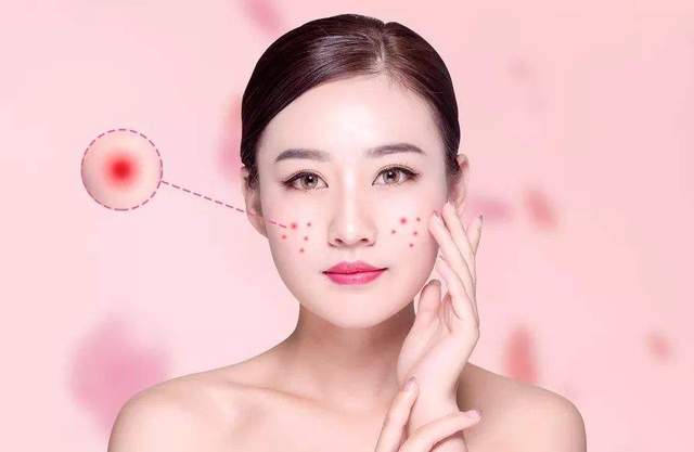 保时捷panamera 用化妆品脸上起小疹子、小疙瘩，怎么办？