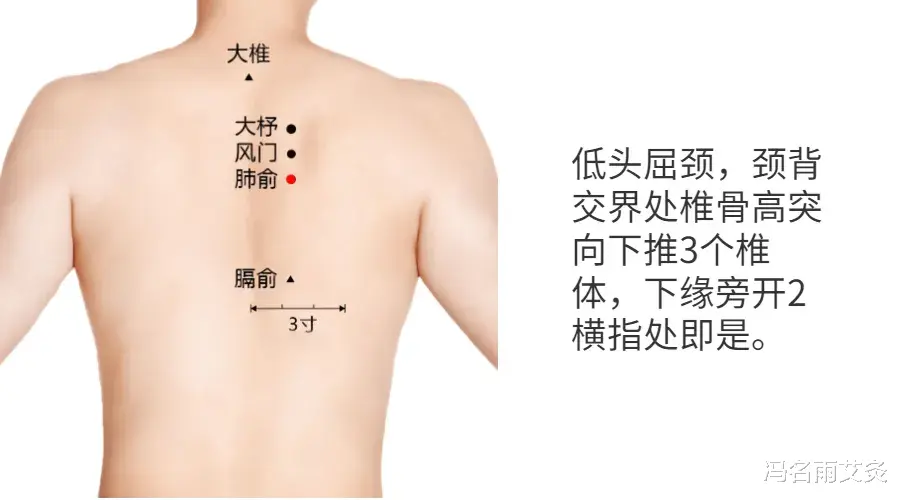 骨折|冬季肺气肿导致咳嗽，气喘，痰多，胸闷，快试试强肺妙穴